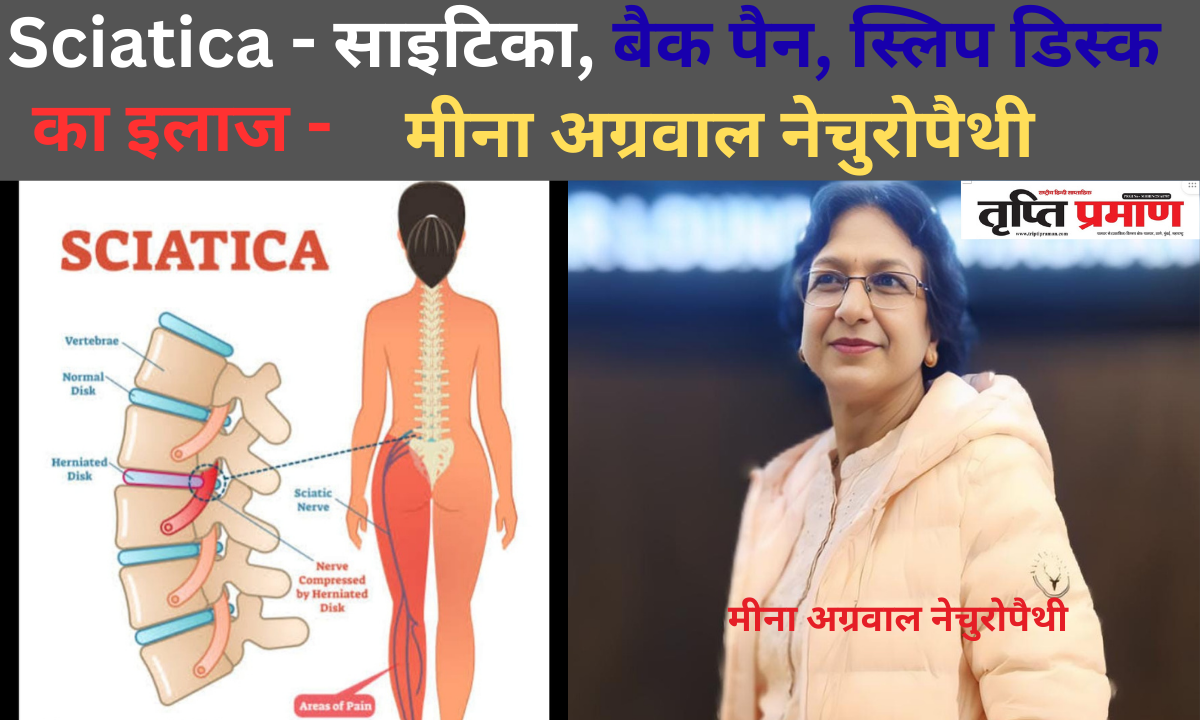 Sciatica – साइटिका, बैक पैन, स्लिप डिस्क का इलाज -मीना अग्रवाल नेचुरोपैथी |