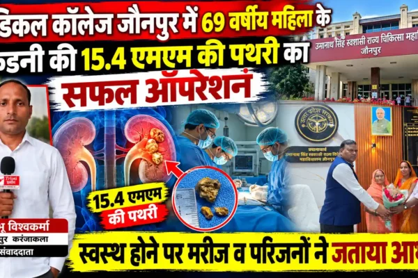 मेडिकल कॉलेज जौनपुर में 69 वर्षीय महिला की किडनी की 15.4 एमएम पथरी का सफल ऑपरेशन |